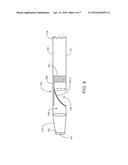 REDIRECTING DELIVERY CATHETER AND METHODS OF USE THEREOF diagram and image