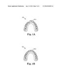 DETERMINING A DENTAL TREATMENT DIFFICULTY diagram and image