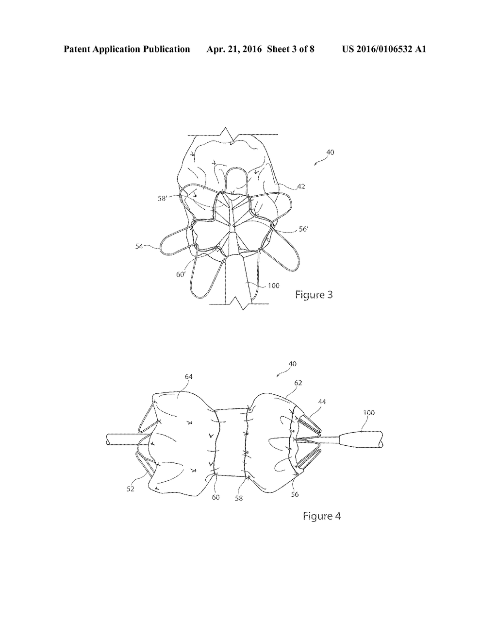 STENT GRAFT AND INTRODUCER ASSEMBLY - diagram, schematic, and image 04