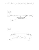 CARDIAC VALVE SUPPORT DEVICE FITTED WITH VALVE LEAFLETS diagram and image