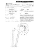 Acetabular Prosthesis diagram and image