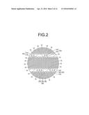 STENT diagram and image