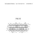 STENT diagram and image