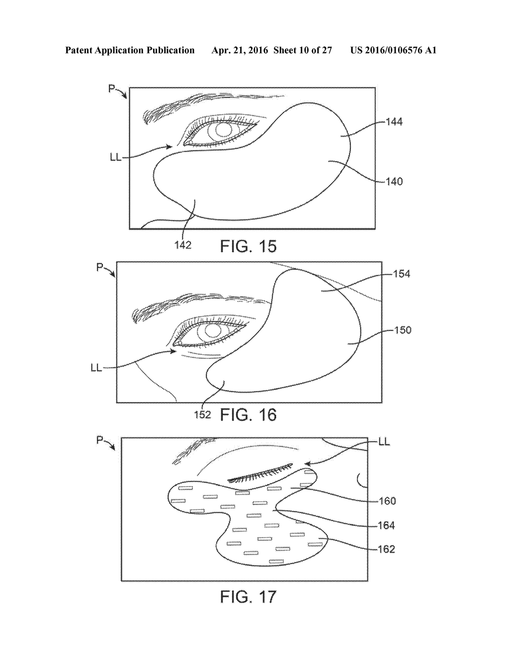 CONTROLLER FOR DRY EYE TREATMENT SYSTEMS - diagram, schematic, and image 11