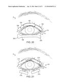 CONTROLLER FOR DRY EYE TREATMENT SYSTEMS diagram and image