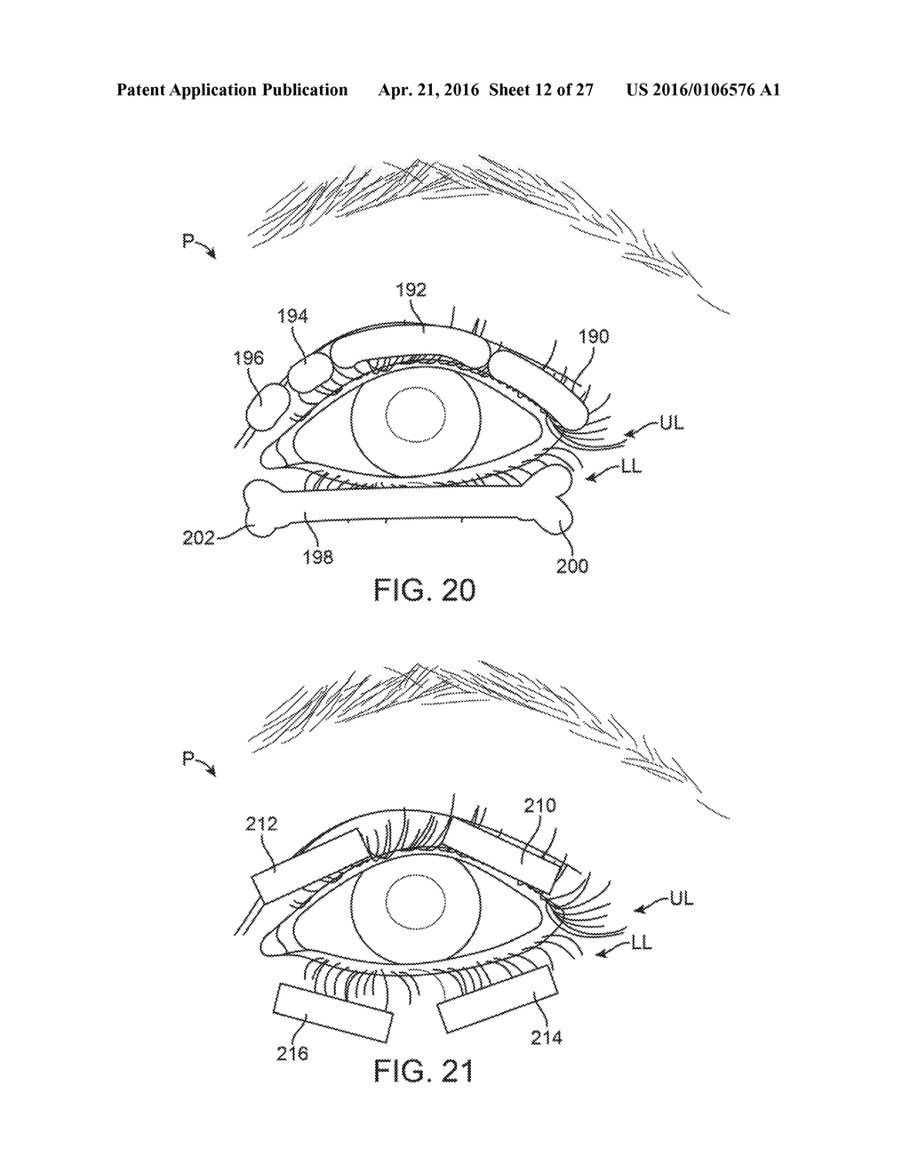 CONTROLLER FOR DRY EYE TREATMENT SYSTEMS - diagram, schematic, and image 13