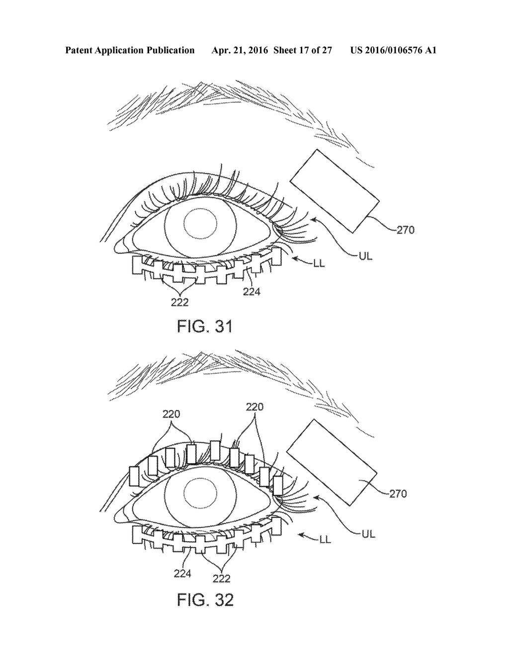 CONTROLLER FOR DRY EYE TREATMENT SYSTEMS - diagram, schematic, and image 18