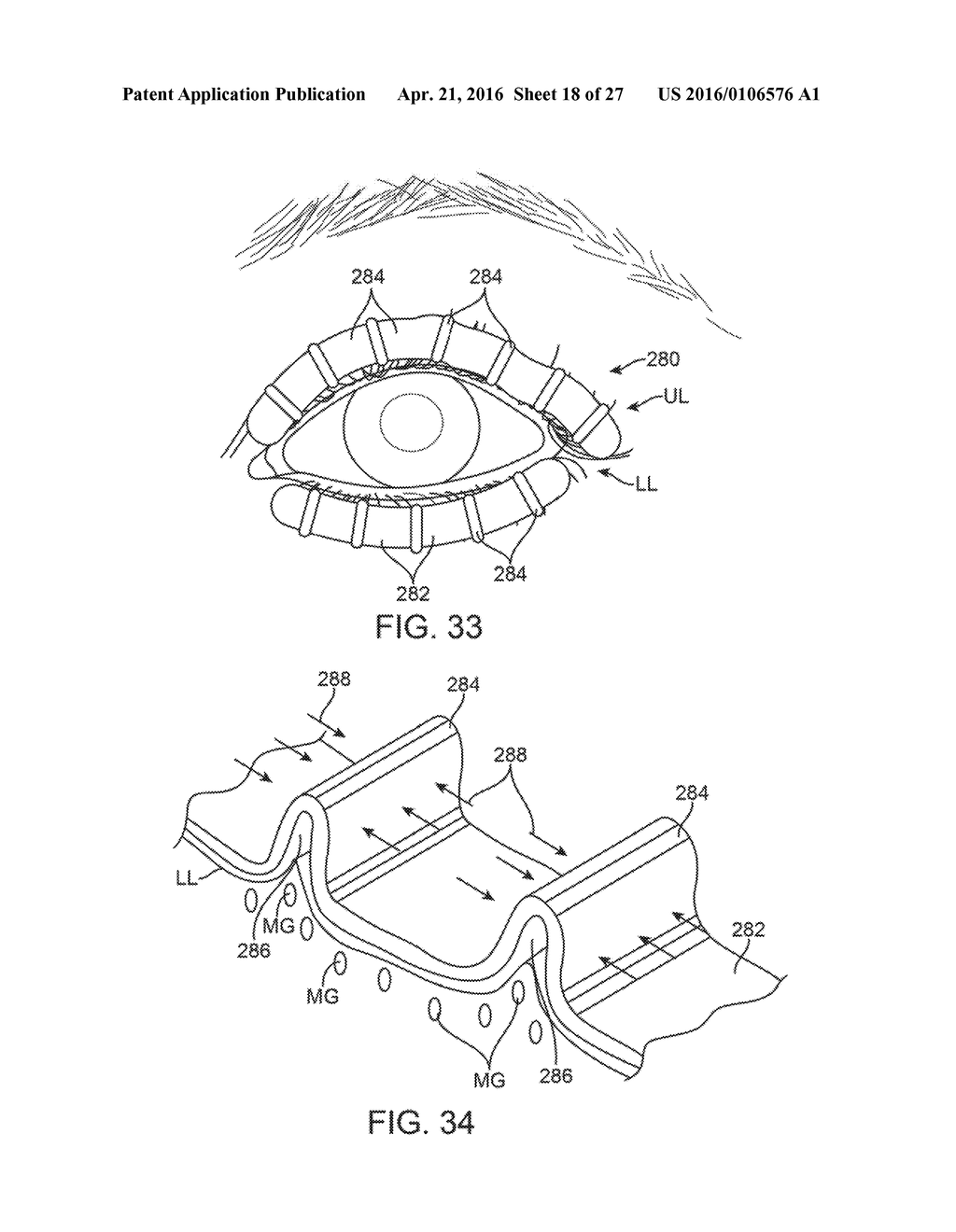 CONTROLLER FOR DRY EYE TREATMENT SYSTEMS - diagram, schematic, and image 19