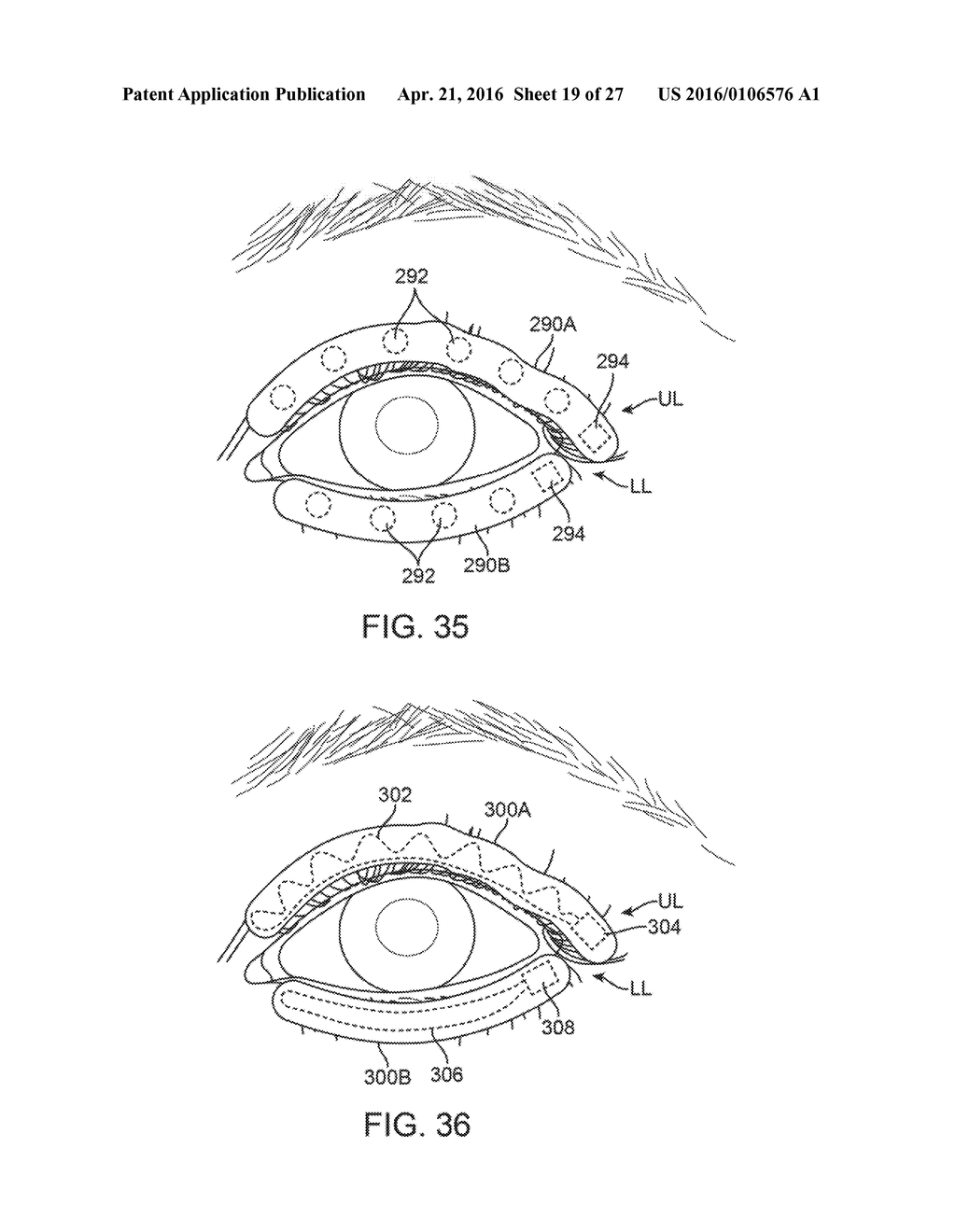 CONTROLLER FOR DRY EYE TREATMENT SYSTEMS - diagram, schematic, and image 20