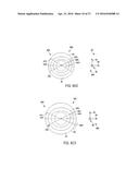 LASER EYE SURGERY LENS FRAGMENTATION diagram and image