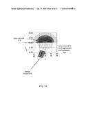 LASER EYE SURGERY LENS FRAGMENTATION diagram and image