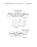 COMBINATION SIS AND VACUUM BANDAGE AND METHOD diagram and image