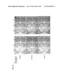 USE OF X-RAY CONTRAST MEDIA AND RELATED COMPOSITIONS FOR THE TREATMENT AND     PREVENTION OF A FILOVIRUS INFECTION diagram and image