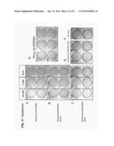 USE OF X-RAY CONTRAST MEDIA AND RELATED COMPOSITIONS FOR THE TREATMENT AND     PREVENTION OF A FILOVIRUS INFECTION diagram and image