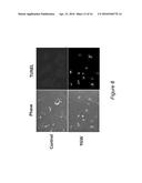 EPIGENETIC MECHANISMS OF ANTI-FIBROTIC ACTION FOR THE LIVER diagram and image