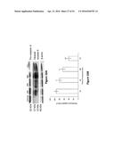 TREATMENT OF CANCER diagram and image