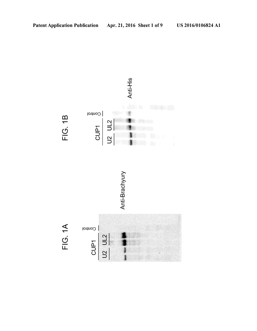 YEAST-BRACHYURY IMMUNOTHERAPEUTIC COMPOSITIONS - diagram, schematic, and image 02