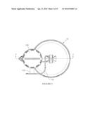 FLUID DRAINAGE CONTAINER diagram and image