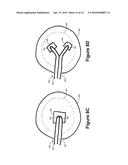 FLUIDIC CONNECTOR FOR IRRIGATION AND ASPIRATION OF WOUNDS diagram and image