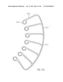 CATHETER DEVICE diagram and image