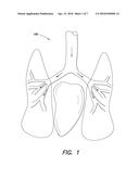 SYSTEM FOR PRODUCING CONTINUOUS MECHANICAL ENERGY TO TREAT HEART FAILURE     WITHOUT THE USE OF EXTERNAL ENERGY SOURCE diagram and image