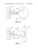 SYSTEM FOR PRODUCING CONTINUOUS MECHANICAL ENERGY TO TREAT HEART FAILURE     WITHOUT THE USE OF EXTERNAL ENERGY SOURCE diagram and image