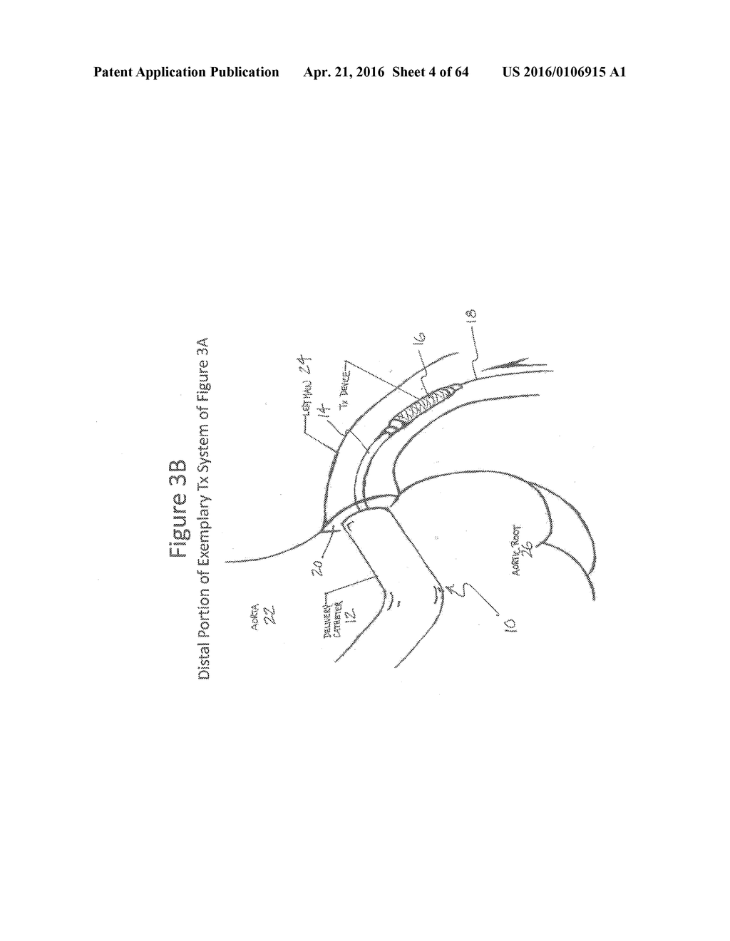 Adjustable Medium Diverter - diagram, schematic, and image 05