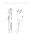 CATHETER SYSTEM diagram and image