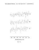 FLUORIDE IONTOPHORESIS DEVICE AND METHOD THEREOF diagram and image