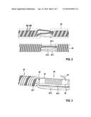 IMPLANTABLE ELECTRICAL LINE diagram and image