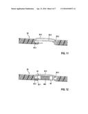 IMPLANTABLE ELECTRICAL LINE diagram and image