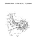 Triphasic Pulses to Reduce Undesirable Side-Effects in Cochlear Implants diagram and image