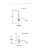 METHODS AND APPARATUSES FOR REMODELING TISSUE OF OR ADJACENT TO A BODY     PASSAGE diagram and image