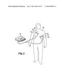 PULSE DETECTION APPARATUS, SOFTWARE, AND METHODS USING PATIENT     PHYSIOLOGICAL SIGNALS diagram and image