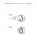 Mouth Protector Adhesion Method diagram and image