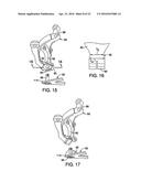 VEHICLE FRONT SUSPENSION diagram and image