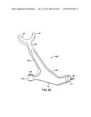 VEHICLE FRONT SUSPENSION diagram and image