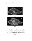 INFLAMMATORY DISEASE DIAGNOSIS AND METHODS OF TREATMENT USING     LIPOPOLYSACCHARIDES-RESPONSIVE BEIGE-LIKE ANCHOR diagram and image