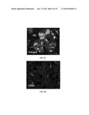 INFLAMMATORY DISEASE DIAGNOSIS AND METHODS OF TREATMENT USING     LIPOPOLYSACCHARIDES-RESPONSIVE BEIGE-LIKE ANCHOR diagram and image