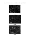 INFLAMMATORY DISEASE DIAGNOSIS AND METHODS OF TREATMENT USING     LIPOPOLYSACCHARIDES-RESPONSIVE BEIGE-LIKE ANCHOR diagram and image