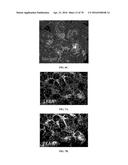 INFLAMMATORY DISEASE DIAGNOSIS AND METHODS OF TREATMENT USING     LIPOPOLYSACCHARIDES-RESPONSIVE BEIGE-LIKE ANCHOR diagram and image