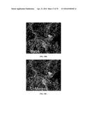 INFLAMMATORY DISEASE DIAGNOSIS AND METHODS OF TREATMENT USING     LIPOPOLYSACCHARIDES-RESPONSIVE BEIGE-LIKE ANCHOR diagram and image