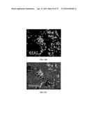 INFLAMMATORY DISEASE DIAGNOSIS AND METHODS OF TREATMENT USING     LIPOPOLYSACCHARIDES-RESPONSIVE BEIGE-LIKE ANCHOR diagram and image