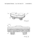 ANTIOXIDANT STABILIZED CROSSLINKED ULTRA HIGH MOLECULAR WEIGHT     POLYETHYLENE FOR MEDICAL DEVICE APPLICATIONS diagram and image