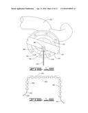 METHOD OF DISTRIBUTING CURRENT IN ELECTRODEPOSITION PROCESS diagram and image