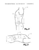 CAPSULE ENDOSCOPE diagram and image