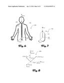 CAPSULE ENDOSCOPE diagram and image