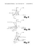 CAPSULE ENDOSCOPE diagram and image