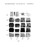 SYSTEMS AND METHODS FOR PERFORMING TRUNCATED-CORRELATION PHOTOTHERMAL     COHERENCE TOMOGRAPHY diagram and image