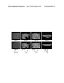 SYSTEMS AND METHODS FOR PERFORMING TRUNCATED-CORRELATION PHOTOTHERMAL     COHERENCE TOMOGRAPHY diagram and image